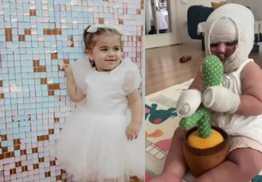 Domates konservesi bomba gibi patladı, 9 aylık bebeğin vücudu yandı 1