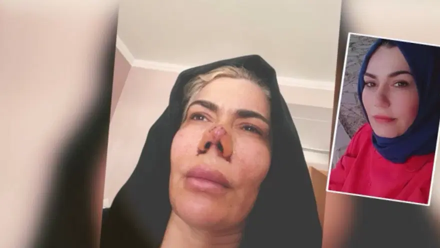 DÖRT YILDA DÖRT AMELİYAT GEÇİRDİ 2