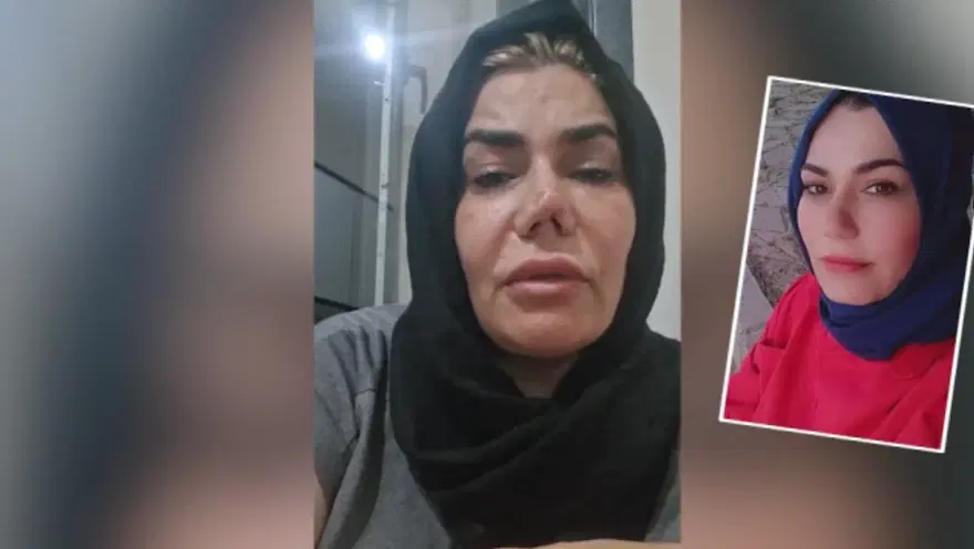 DOKTORU YENİDEN AMELİYAT ÖNERDİ 1