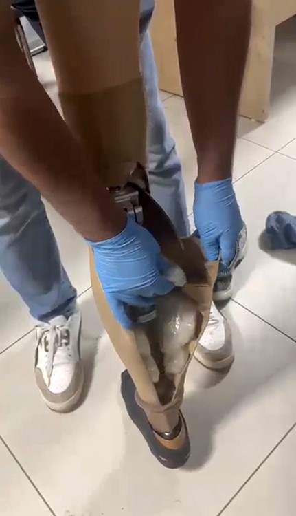 Protez bacağından 830 gram uyuşturucu çıktı